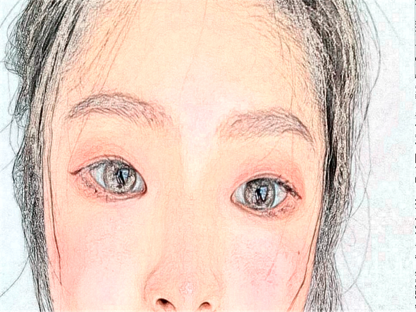 西安近视眼手术哪家医院比较好?附价格