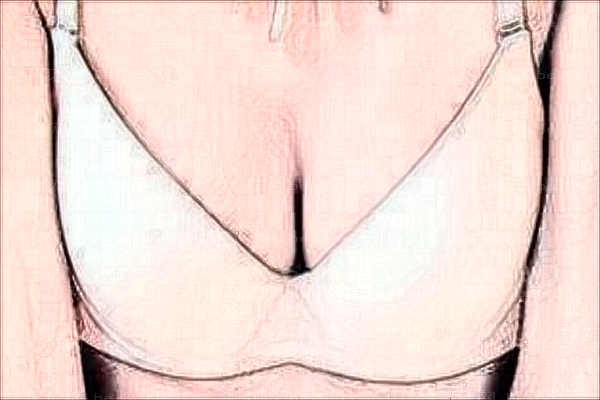 郑州乳房下垂矫正整形专家介绍_前八名单查看
