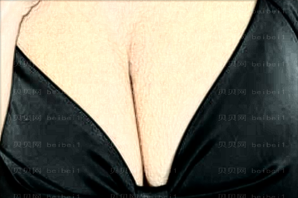 沈阳去副乳整形医生前六公布(医生名单一览)