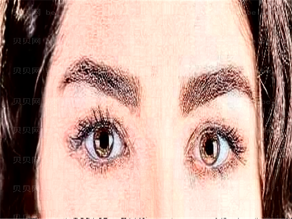 深圳希玛眼科矫正近视眼有什么优势?靠谱吗?