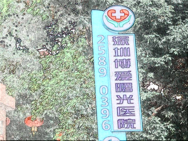 深圳博爱曙光医院近视眼手术做的好吗?术后恢复的快吗?
