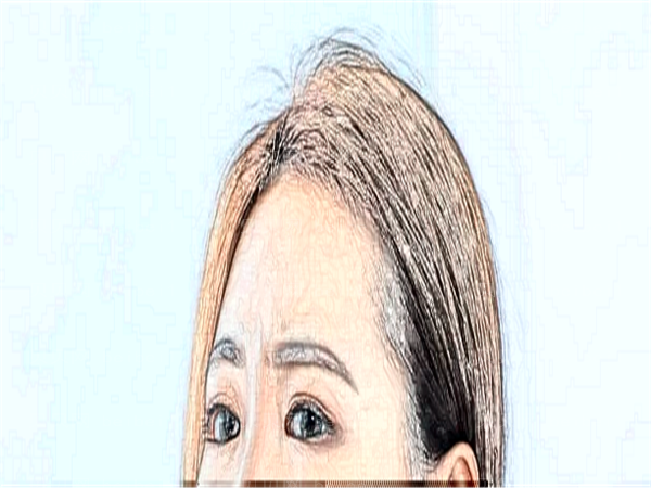 成都瞳仁视康眼科医院近视眼手术人气医生优先了解_评选整理