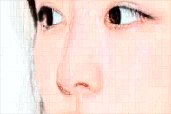 温州和平鼻部综合有哪些项目?附整形价格一览