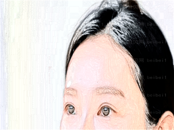 宁波近视眼手术专家介绍_前六名单揭晓