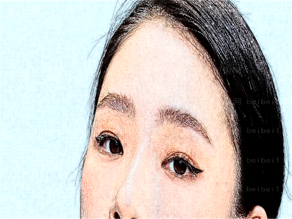 长春近视眼手术专家介绍(长春前三近视眼手术医生名单一览)