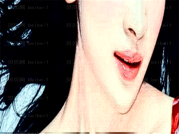 鼻基底抬高后露鼻孔怎么办?鼻基底如何自然变高?