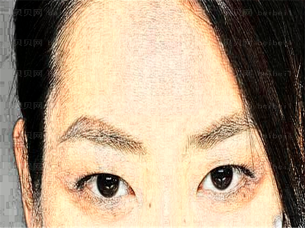 武汉艺星去黑眼圈医生有哪些?医生排名了解一下!