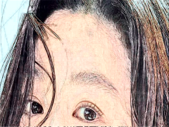 合肥美舒雅眼部综合好的医生有谁?排名名单公布