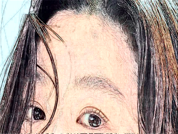 合肥美舒雅眼部综合好的医生有谁?排名名单公布