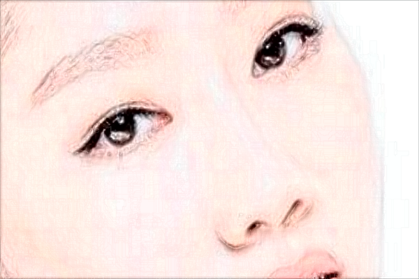 南昌艾莱芙隆鼻恢复期要多久?附整形价格一览
