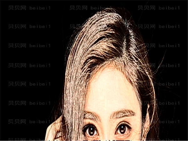 长春双眼皮整形医生介绍(前七医生名单分享)