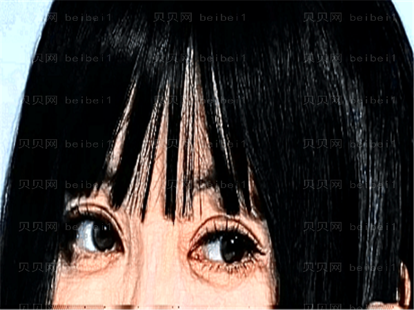 长春双眼皮整形医生介绍(前七医生名单分享)