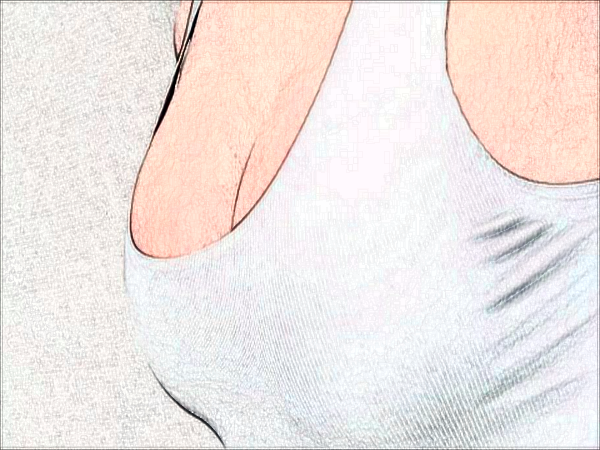 广州高尚乳房下垂矫正好吗?附整形价格一览