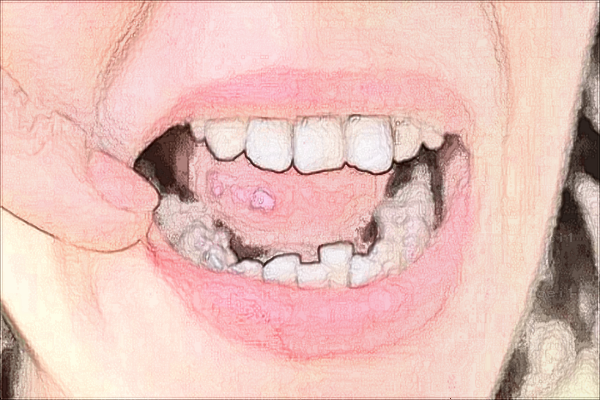 孝感中尚口腔牙齿矫正哪些医生好?技术好的医生推荐