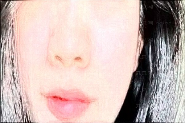 西安艺星隆鼻价格贵不贵?西安艺星医院简介