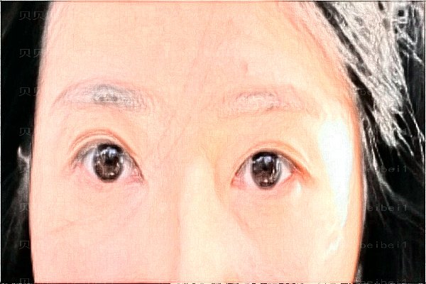 上海玫瑰开眼角收费标准参考(上海玫瑰开眼角医生介绍)