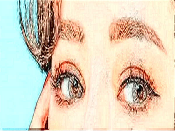 上海眼部综合整形专家介绍(前十名单有哪些)