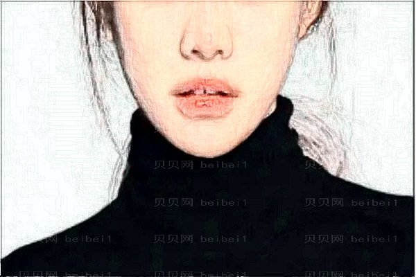 南京美莱自体脂肪填充红榜医生名单,技术好人气高