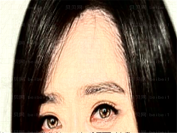 青岛华韩植发医生介绍,介绍精选这些