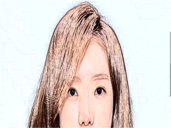 近视手术有哪些项目?需要多少钱?