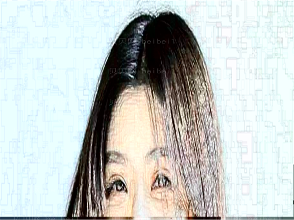近视手术有度数限制吗?多少度后就不能做了?