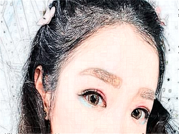 北京东方瑞丽眼部修复做的怎么样?价格价目一览