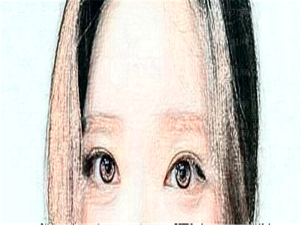 上海开眼角整形专家介绍(上海前四开眼角专家名单一览)