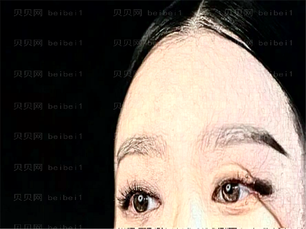 黑龙江近视手术专家大盘点,这几位站榜单前三！