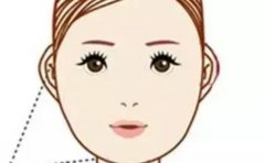 惠州颧骨颧弓较好的医院介绍，技术优势一一列举