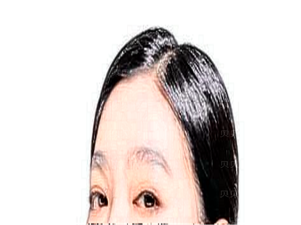 岳阳爱尔眼科医院近视手术多少钱(整形价目及医生团队查看)