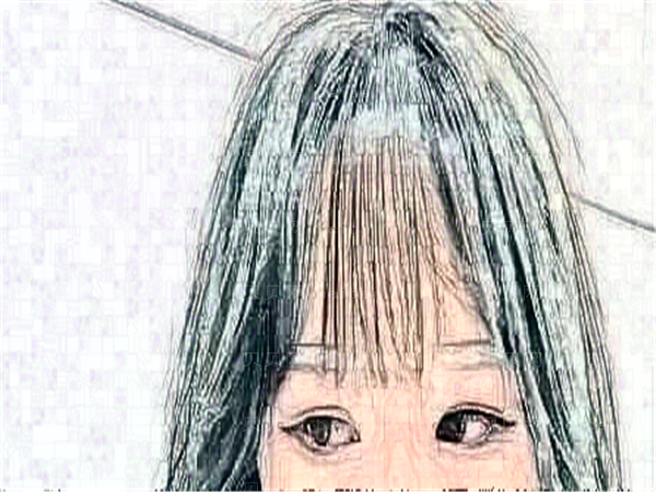 成都近视眼手术专家介绍,前五名单查看
