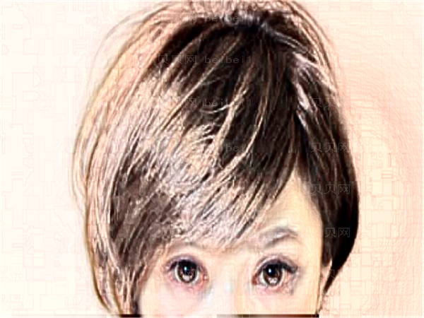 山东阳光美容开眼角如何?附实力专家名单