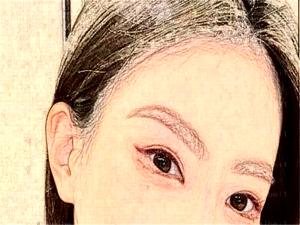 济南普瑞眼科医院近视手术的医生技术好不好?价格参考