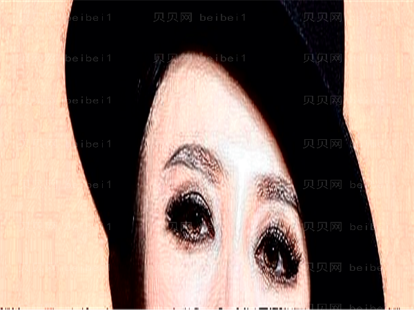 连云港爱尔眼科医院近视手术专家介绍公示！专家排名介绍