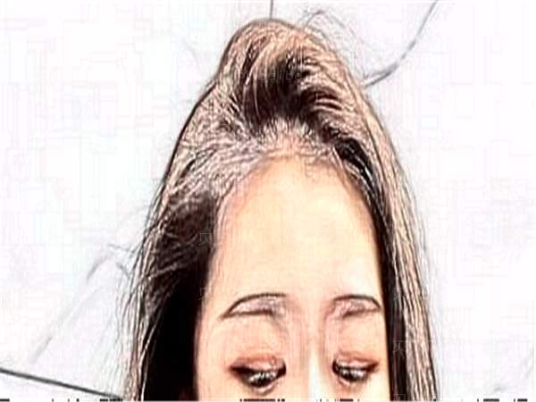 湖南近视手术实力医生大盘点!这几位位列榜单前五