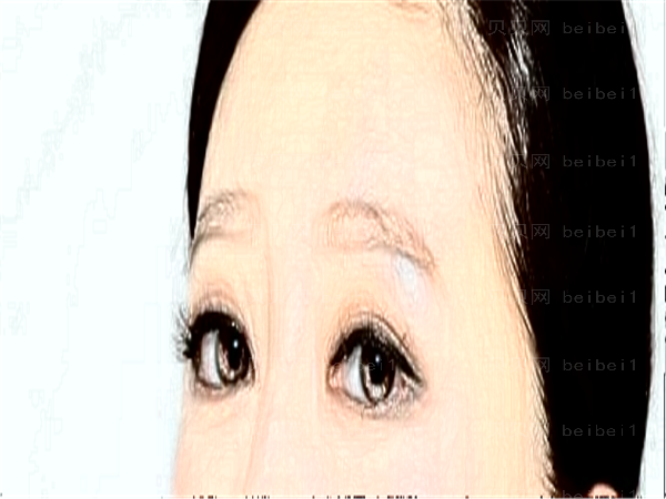 济南爱容整形眼部整形口碑怎么样?专家排名介绍