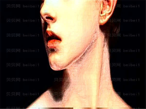 重庆精美整形鼻孔整形做的怎么样?全新价格曝光!