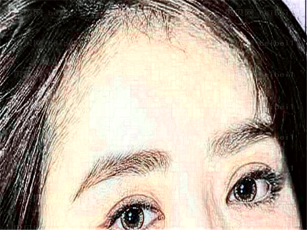 阳江爱尔眼科医院近视手术专家介绍,主要关注这几位就够了