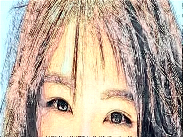 北京花皇医疗重睑手术医生做的如何?这几位口碑不错