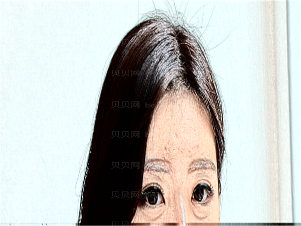 昆明眼科医院近视手术医生介绍+排名榜查看
