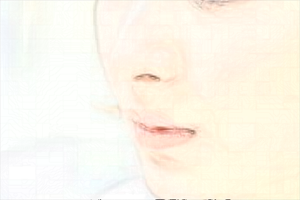 脂肪填充后多久恢复自然?术后的注意事项有哪些?