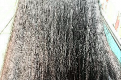 植发养发需要多少钱?能保持多久?