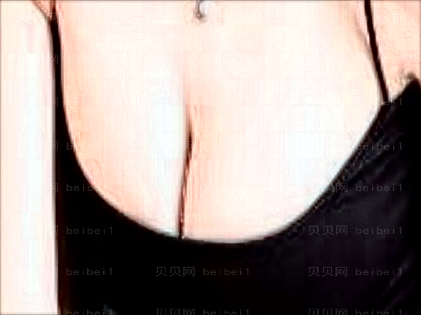北京炫美隆胸技术怎么样_附专家介绍