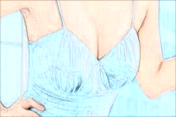 上海伊莱美医疗乳房下垂提升医生技术如何?实力派测评