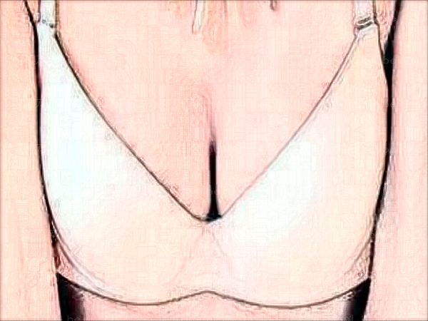 长沙吸脂去副乳医院前十名次名单等你来看