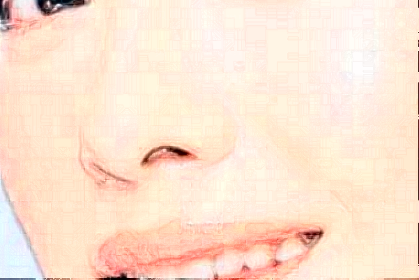 临沂鼻小柱延长前三名医院介绍,快来看看!