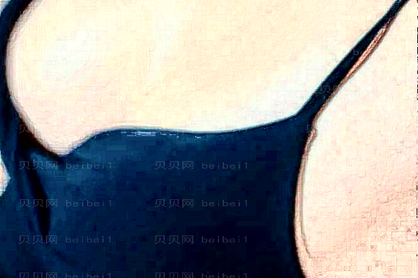 佛山抽脂瘦胸医院名单?排名靠前的医院有哪些