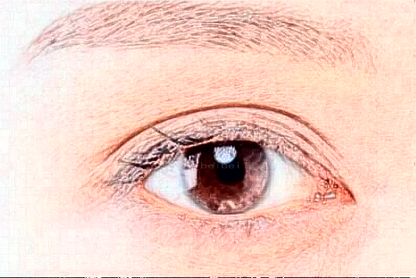 湖州抽脂消除肿眼泡前七名医院介绍?全部干货!