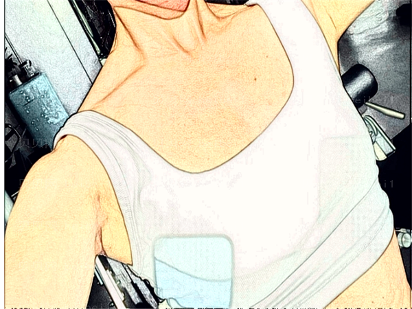 广州乳头内陷矫正专家介绍_六强医生名单出炉