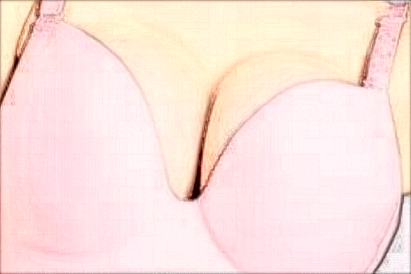 如何选择自体脂肪隆胸和假体隆胸?哪一个更好一点?